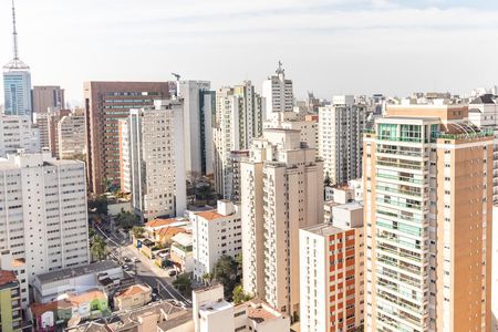 Apartamento à venda com 63m², 2 quartos e 2 vagasSuíte - vista