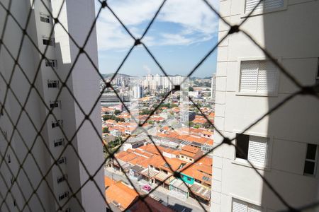 Apartamento para alugar com 66m², 3 quartos e 2 vagasVista - Suíte