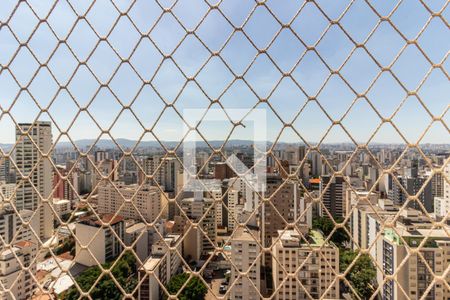 Apartamento para alugar com 317m², 4 quartos e 5 vagasSuíte 1 - Quarto - Vista